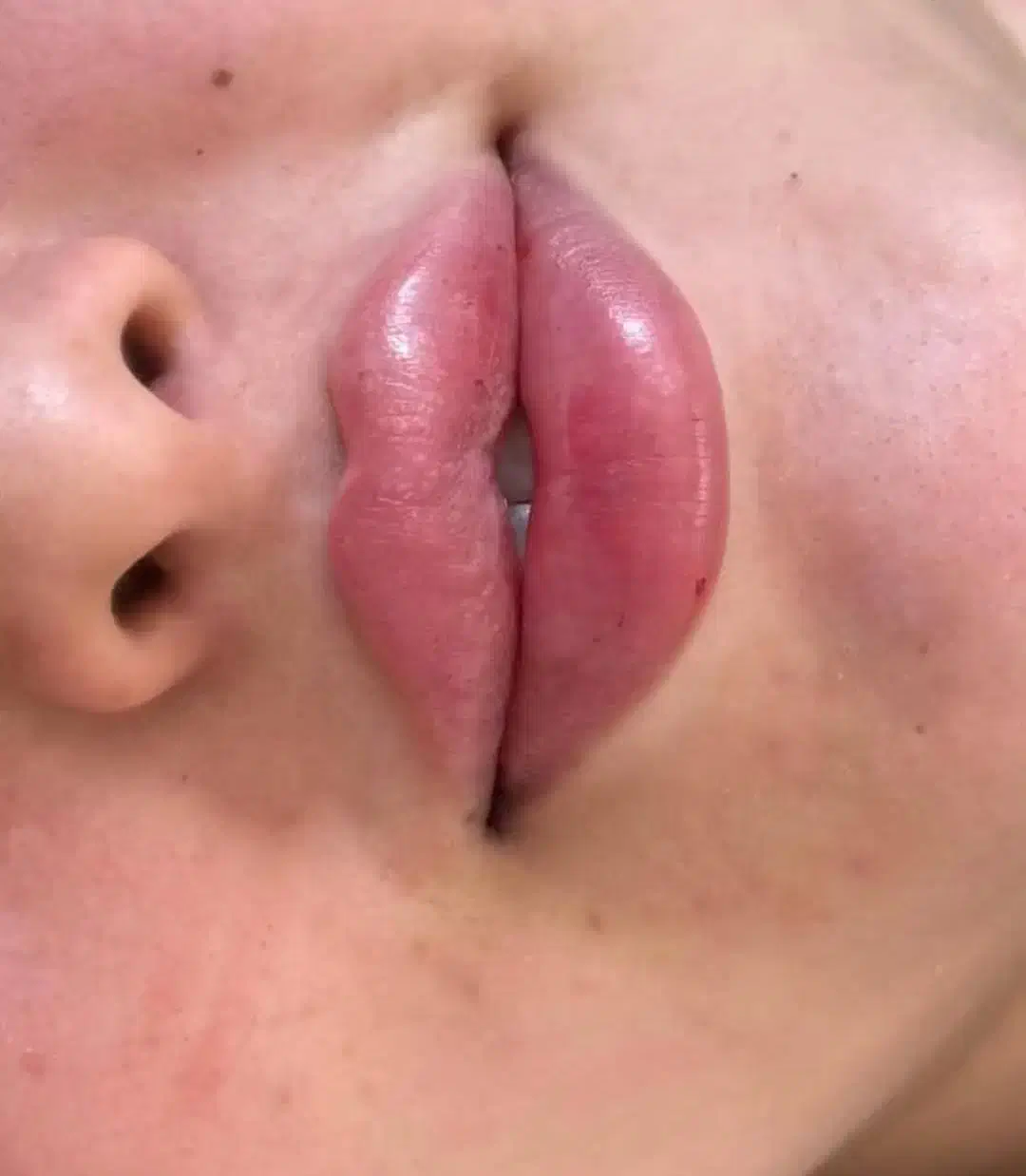 جشنواره خدمات حرفه ای درمان پوست و مو|خدمات آرایشگری و زیبایی|بستان آباد, |دیوار