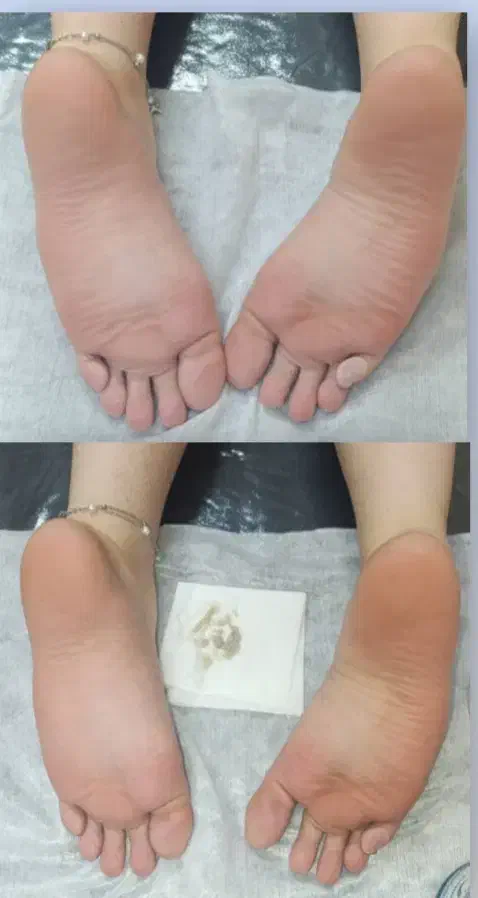 خدمات کفسابی پدیکور|خدمات آرایشگری و زیبایی|خرمآباد, |دیوار