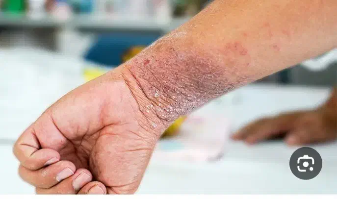 خداحافظی کنید بااگزما|آرایشی، بهداشتی، درمانی|اسلام‌شهر, مسکن مهر اسلاشهر (شهرک امام خمینی)|دیوار