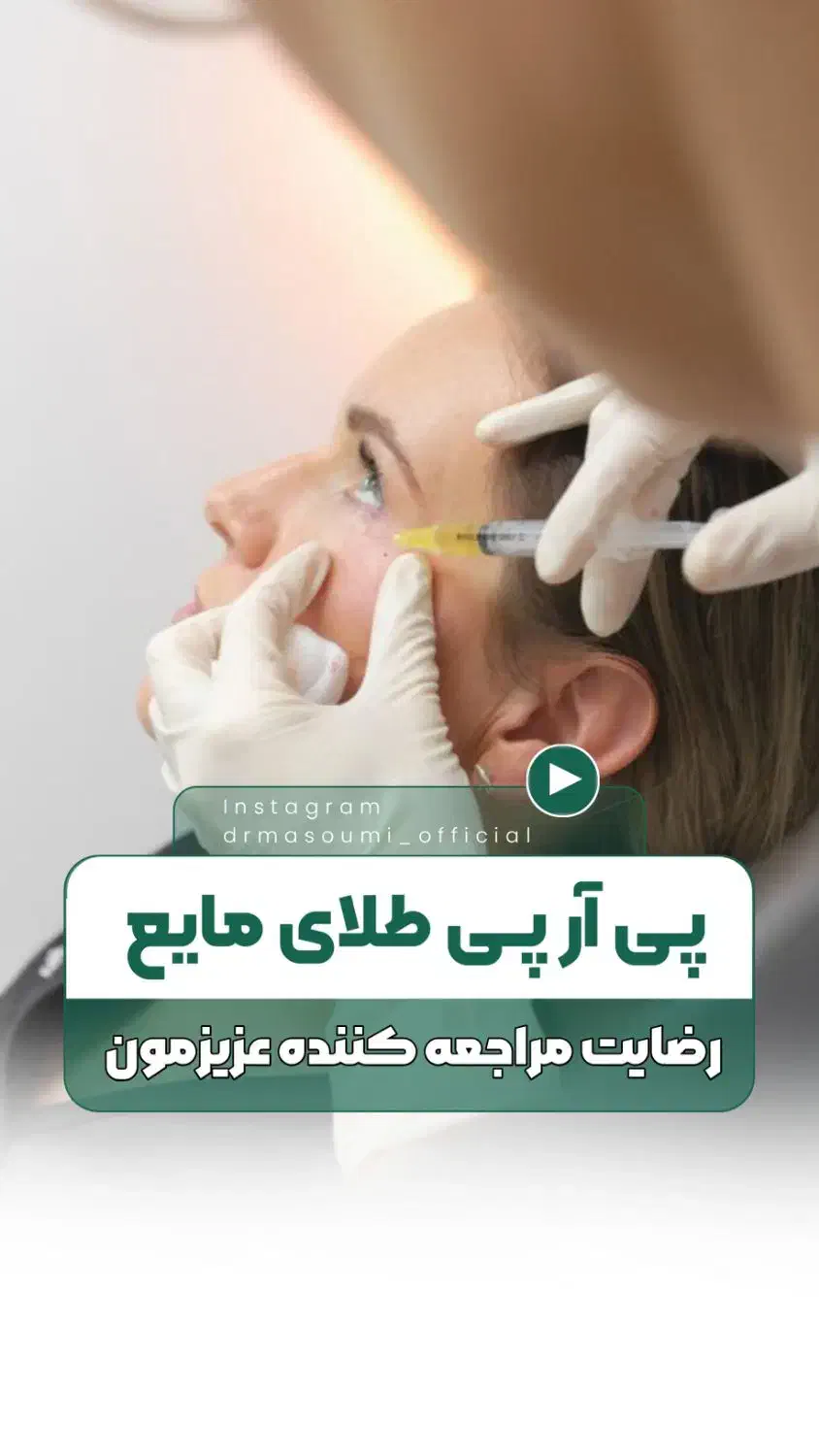 بلفاروپلاستی- ژل بوتاکس توسط دکتر جراح عمومی|خدمات آرایشگری و زیبایی|اصفهان, مهدی آباد|دیوار