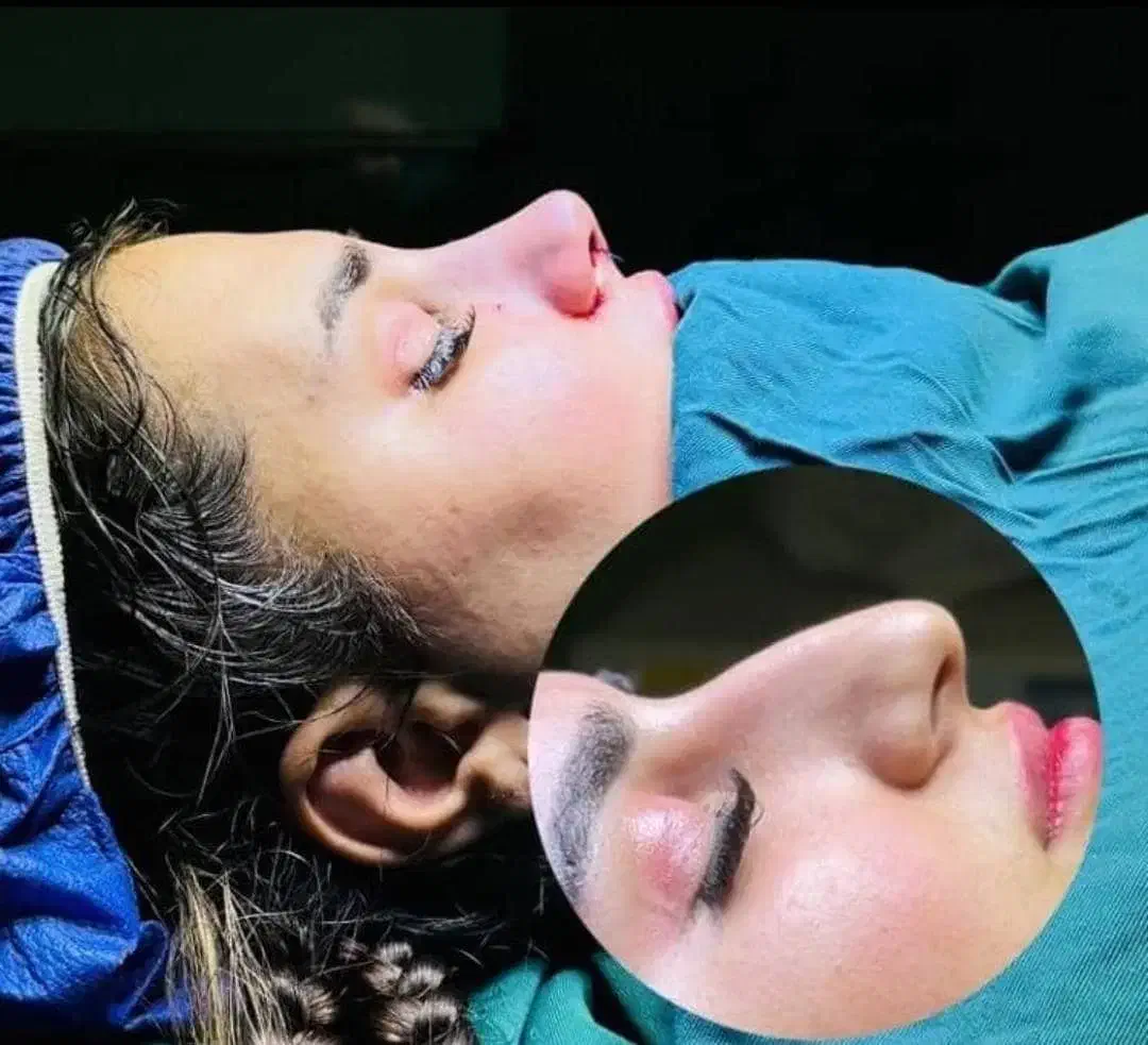 جراحی عمل بینی/لیپو ابدو/بلفارو/لیفت/لیپو ساکشن|خدمات آرایشگری و زیبایی|تهران, فلسطین (میدان انقلاب)|دیوار