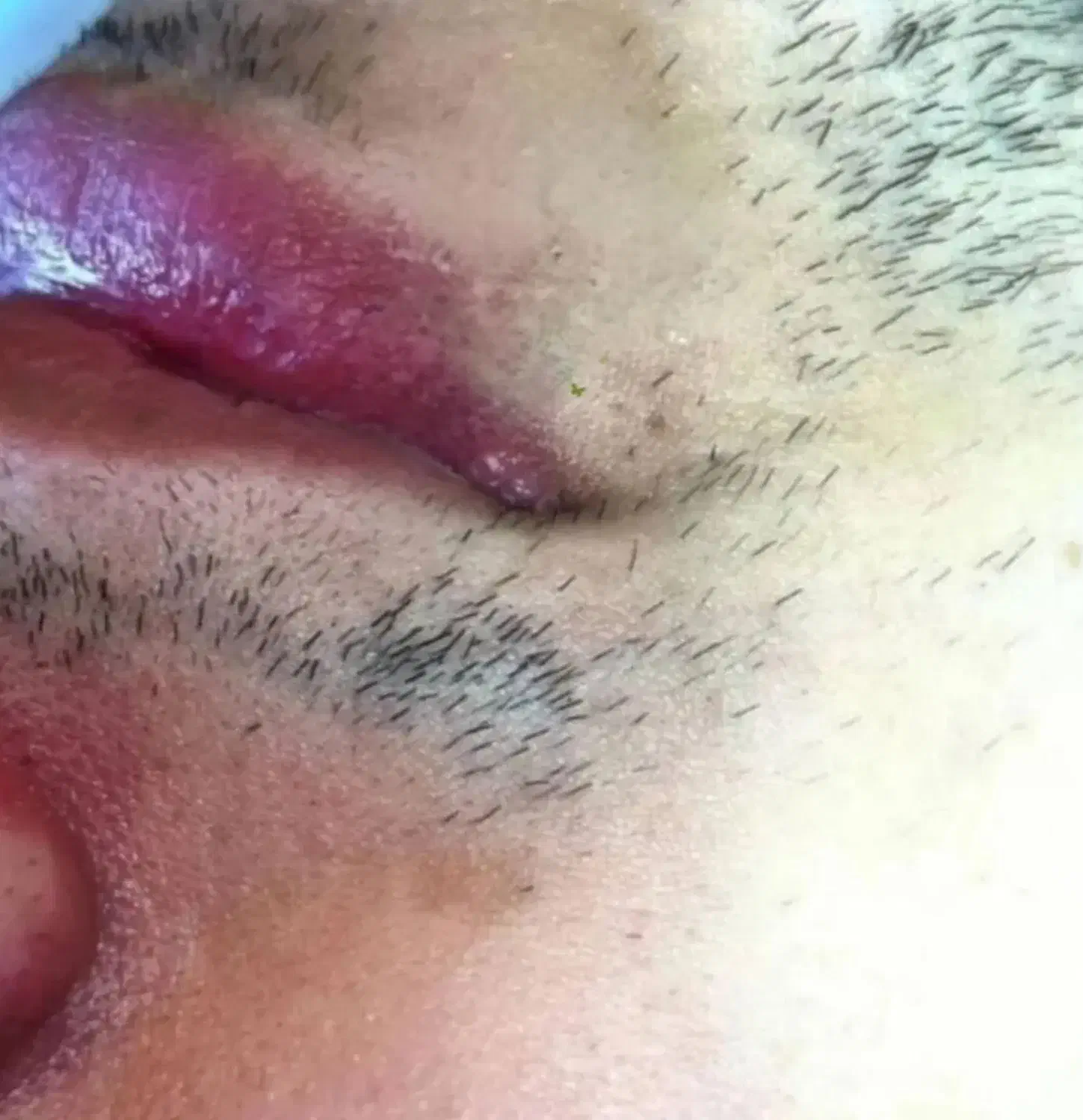 الکترولیز تنها روش قطعی از بین بردن هر نوع مو|خدمات آرایشگری و زیبایی|صدرا-فارس, فاز ۱|دیوار