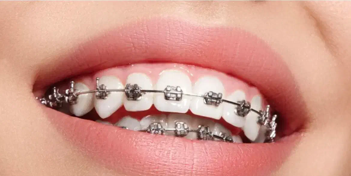 دستیار دندانپزشک|استخدام درمانی، زیبایی، بهداشتی|تبریز, |دیوار