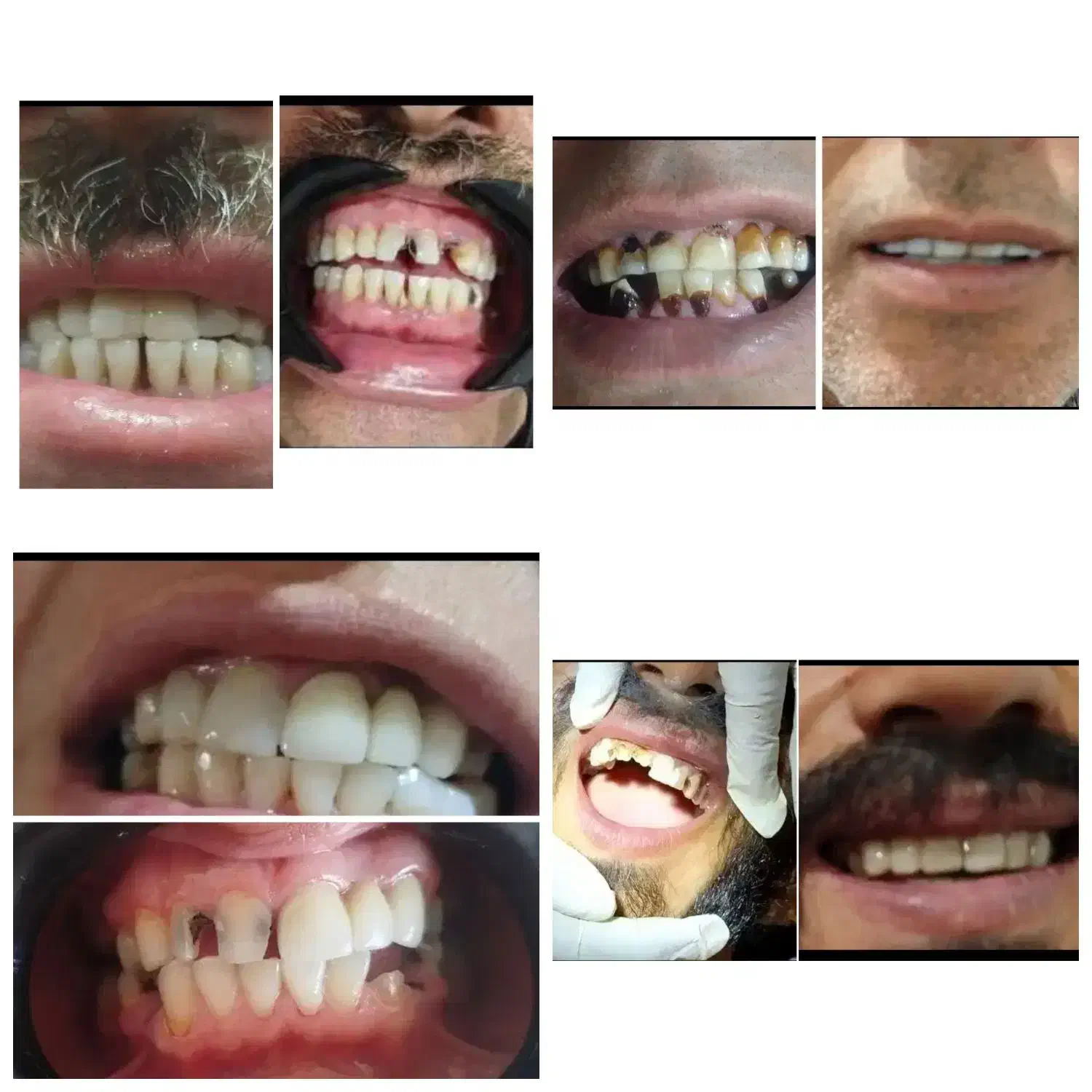 اورژانس دندانپزشکی در منزل شما شبانه‌روزی|خدمات آرایشگری و زیبایی|کرج, فاز ۱ مهرشهر|دیوار