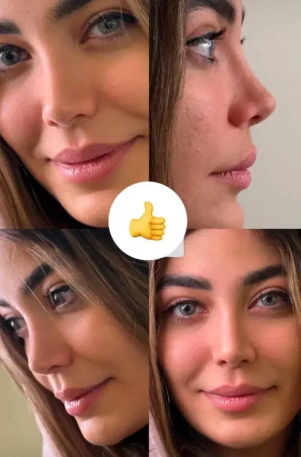 عمل جراحی بینی فقط 28.900 درکرج بدون تامپون(ENT)|خدمات آرایشگری و زیبایی|کرج, جهان‌شهر|دیوار