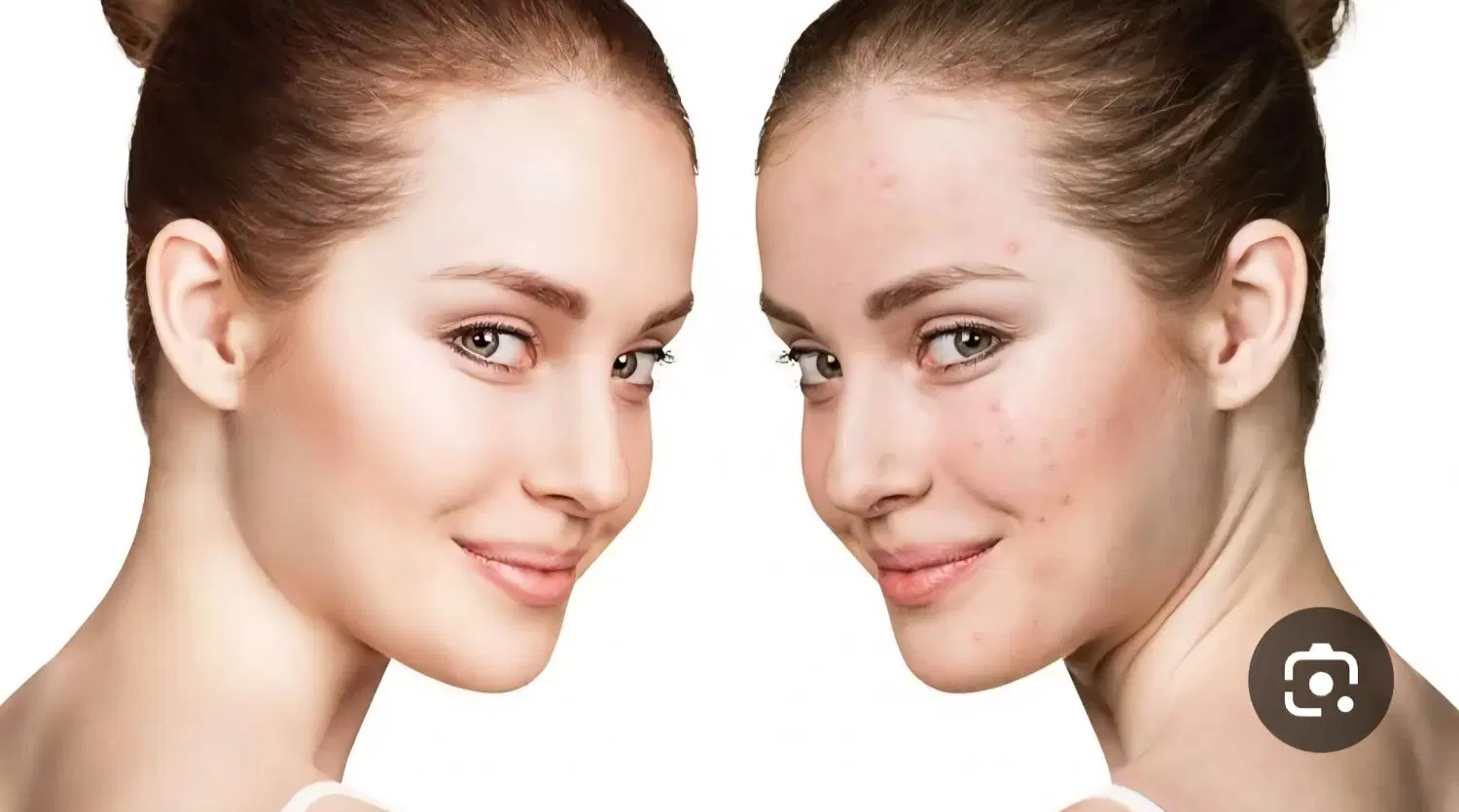 فیشیال تخصصی|خدمات زیبایی و سلامت|تهران, فدک|دیوار