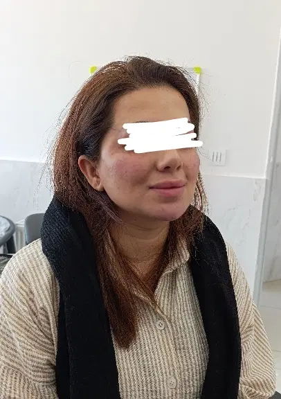 فیلر|خدمات زیبایی و سلامت|اسلام‌‌آباد غرب, |دیوار