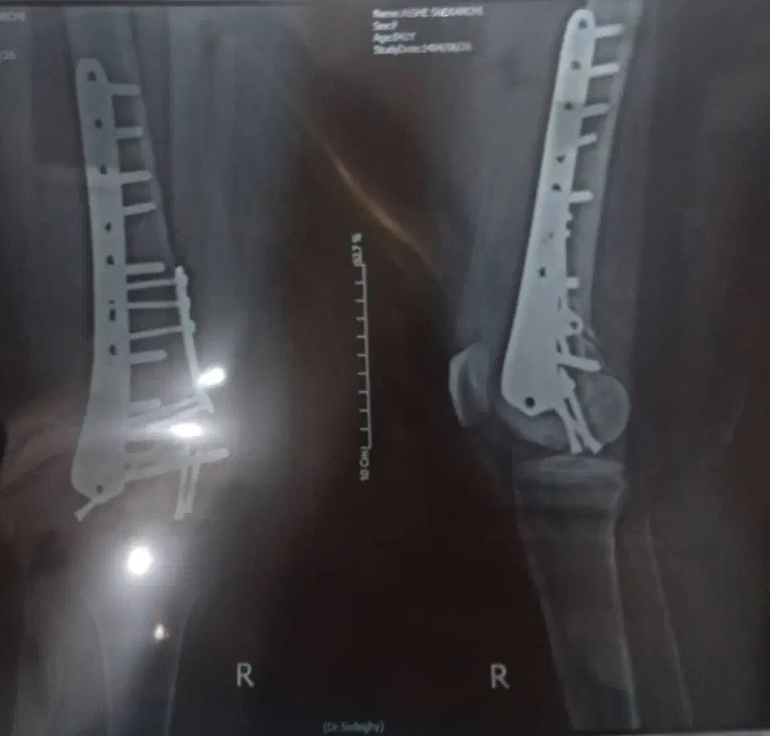 نیازفوری به ۱۰ ملیون پول دارم|فعالیت داوطلبانه تحقیقاتی|تبریز, |دیوار