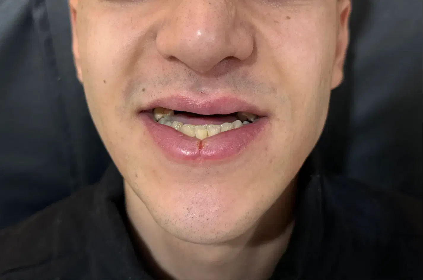 دندان مصنوعی + دندانسازی|خدمات آرایشگری و زیبایی|تهران, شمشیری|دیوار