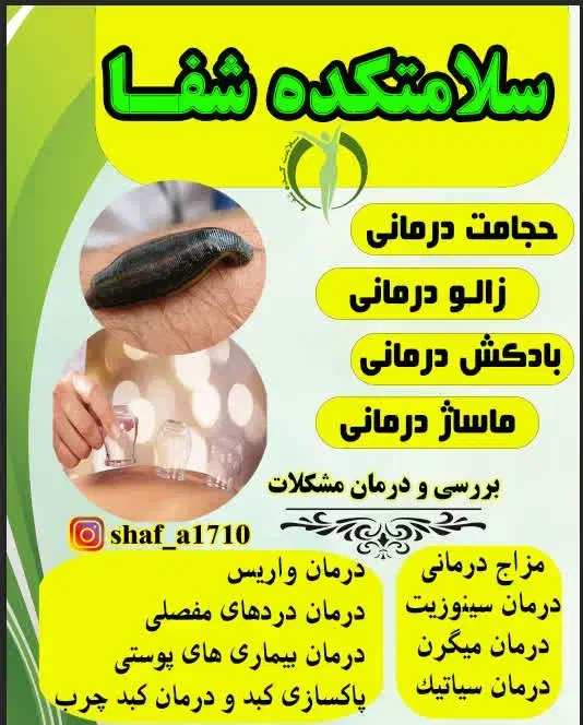 حجامت|خدمات آرایشگری و زیبایی|اسلام‌‌آباد غرب, |دیوار