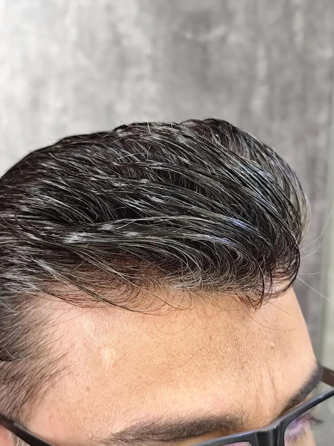 پروتزمو /خط رویش تار به تار /|خدمات زیبایی و سلامت|اصفهان, آفاران|دیوار