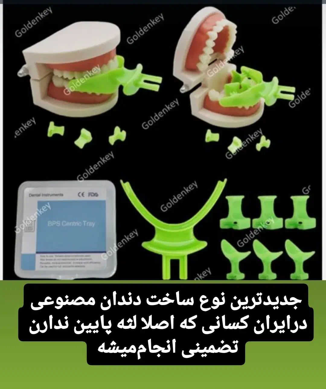 دندان مصنوعی المانی ضمانت ده سال|آرایشی، بهداشتی، درمانی|بوئین زهرا, |دیوار