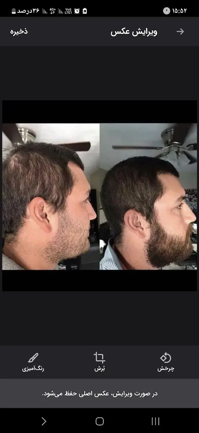 ریزش مو/رویش مجدد/رشد قدی مو /درمان کم پشتی مو|آرایشی، بهداشتی، درمانی|چاه داد خدا, |دیوار