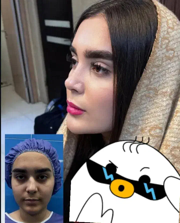 مرکزفوق تخصصی جراحی بینی/وجشنواره۱۰روزهشگفت انگیز|خدمات آرایشگری و زیبایی|مشهد, احمدآباد|دیوار