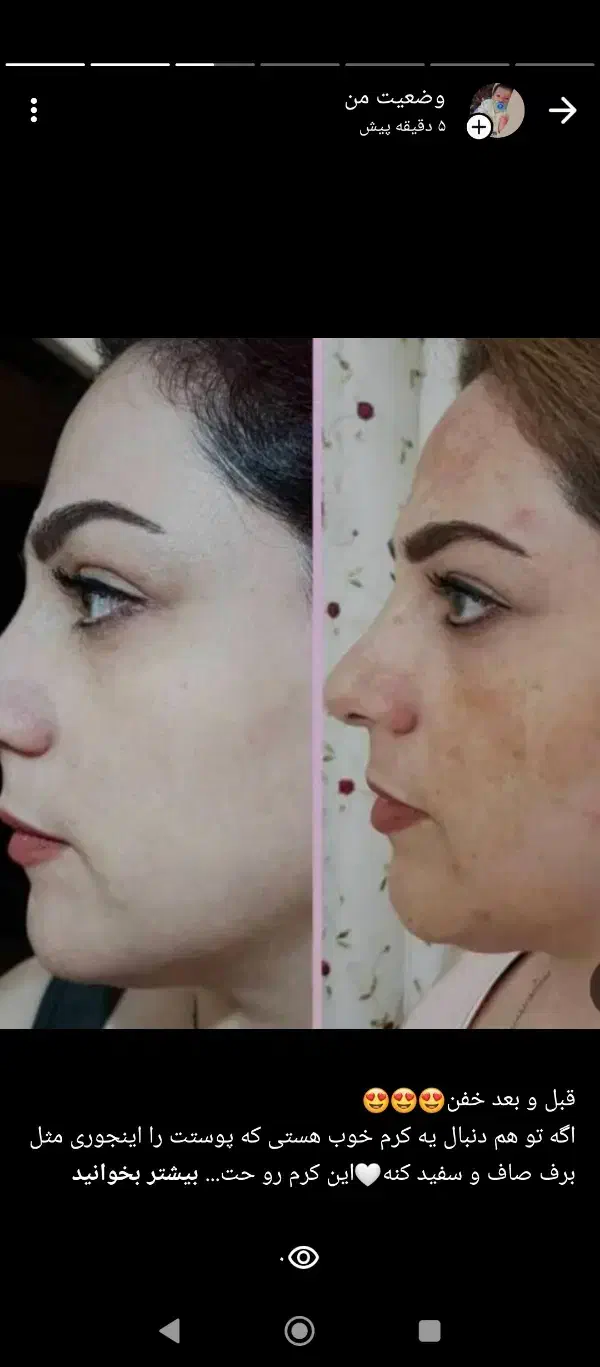 کرم شب vipملکه . صابون کوجی سان .گلوتاتیون اصل|آرایشی، بهداشتی، درمانی|کرمان, |دیوار