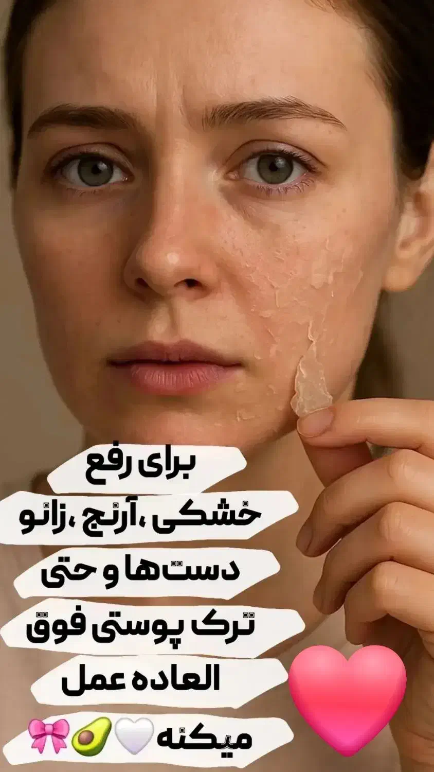 کرم جوانه گندم اصل|آرایشی، بهداشتی، درمانی|چالوس, |دیوار