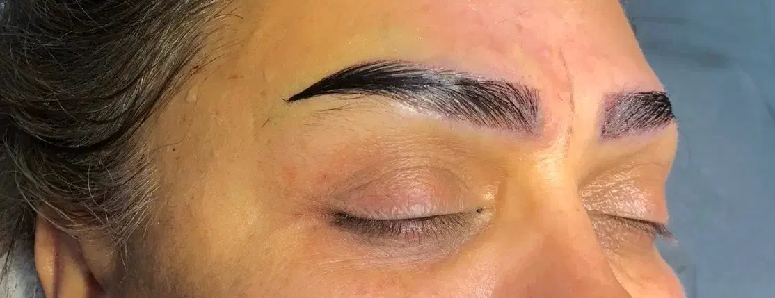 کاشت ابرو توسط تیم V.I.P تحت نظر پزشک متخصص کلینیک|خدمات آرایشگری و زیبایی|اردبیل, |دیوار