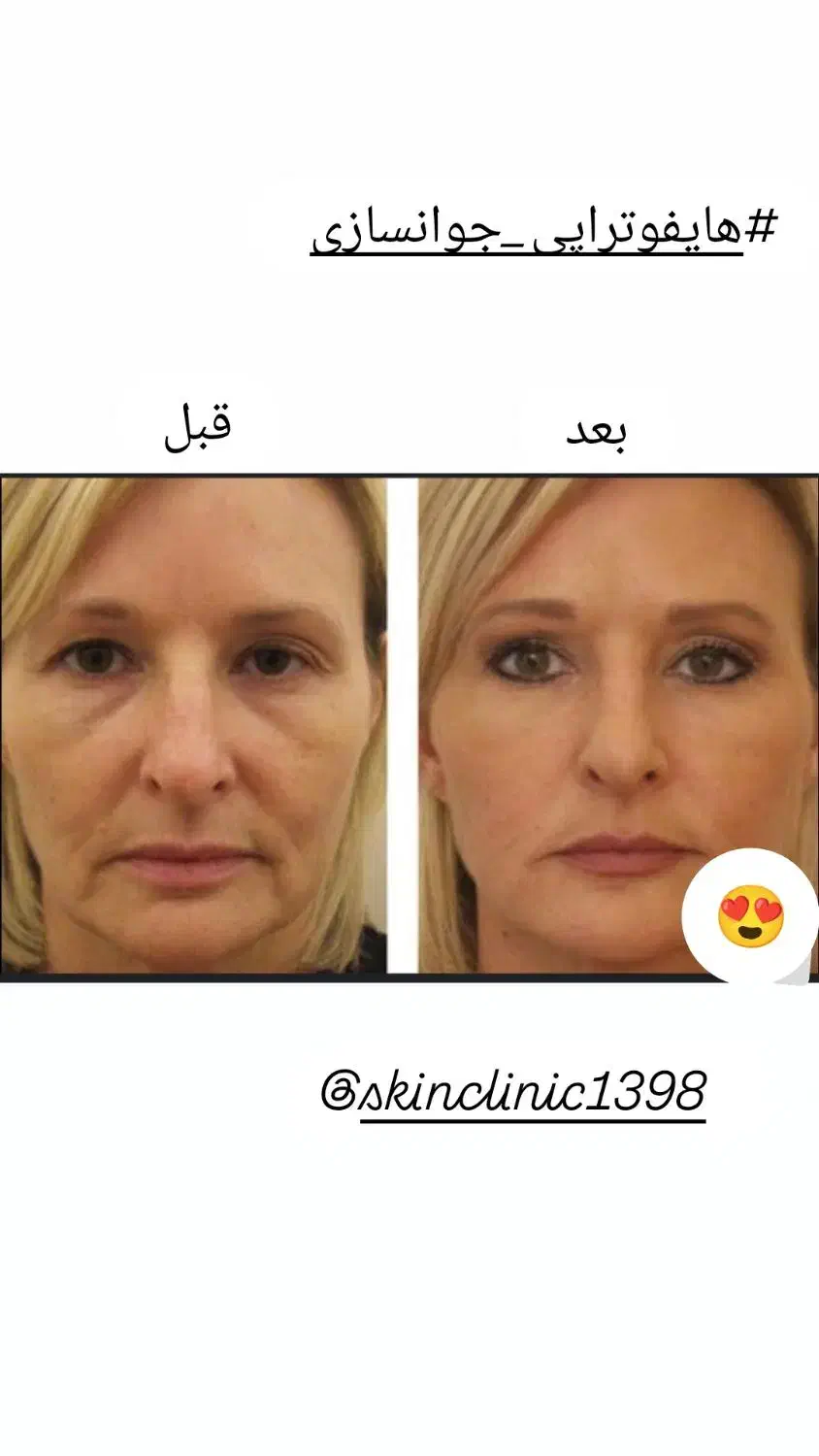 کلینیک پوست و مو|خدمات آرایشگری و زیبایی|تهران, خانی آباد نو شمالی|دیوار