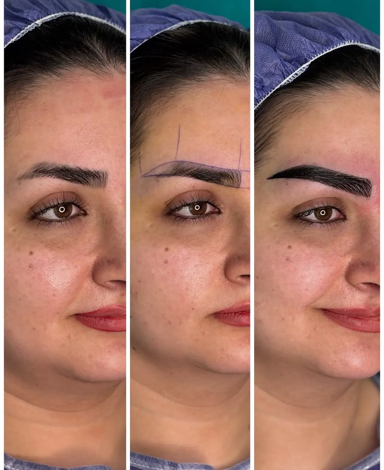 کاشت ابرو با جدید ترین روش کاشت از تهران|خدمات زیبایی و سلامت|تبریز, |دیوار