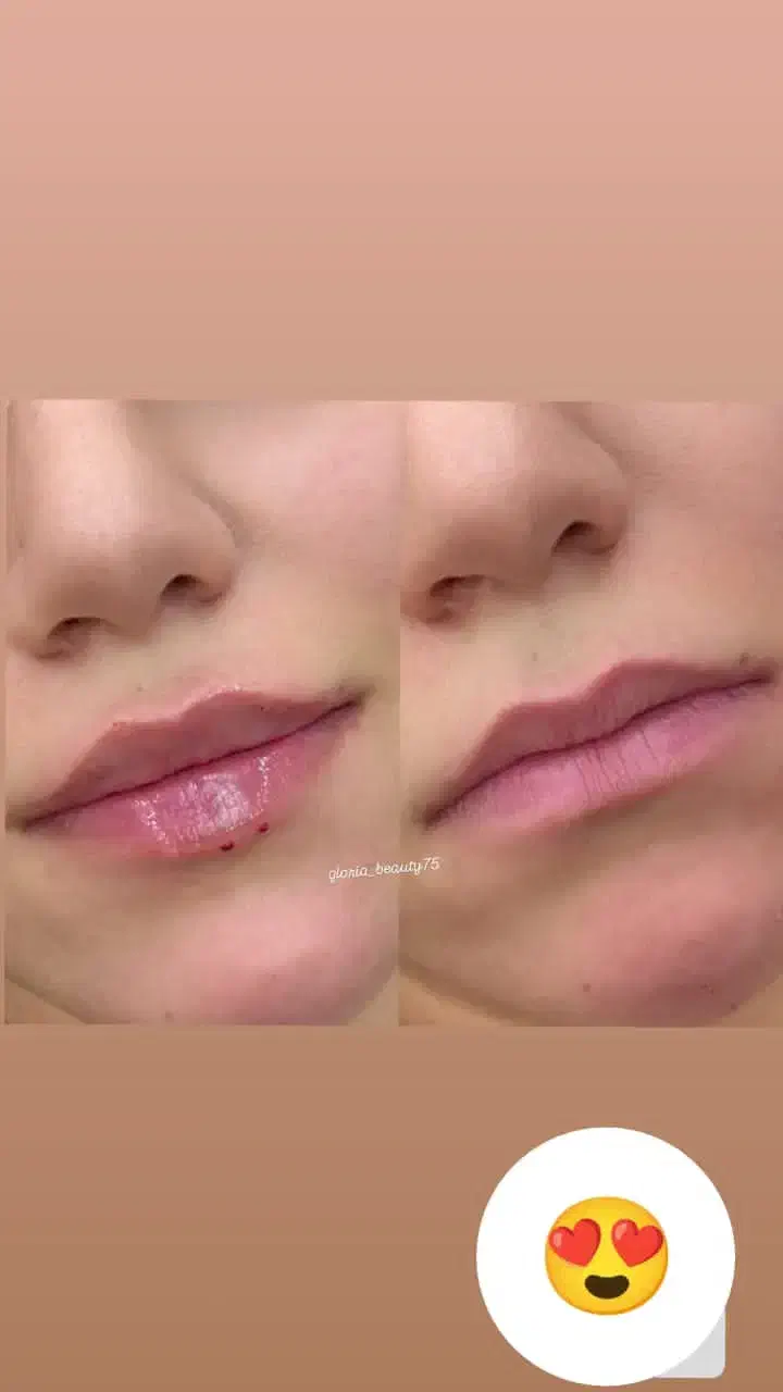 جشنواره ویژه یلدایی ژل،بوتاکس،پرسینگ|خدمات آرایشگری و زیبایی|ملایر, |دیوار