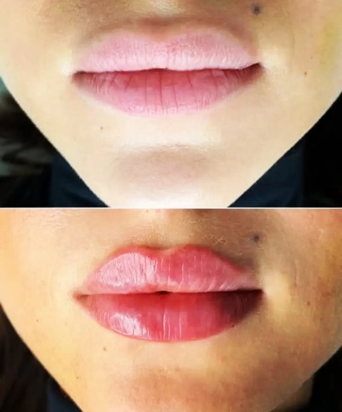 ژل و بوتاکس|خدمات آرایشگری و زیبایی|چناران, |دیوار