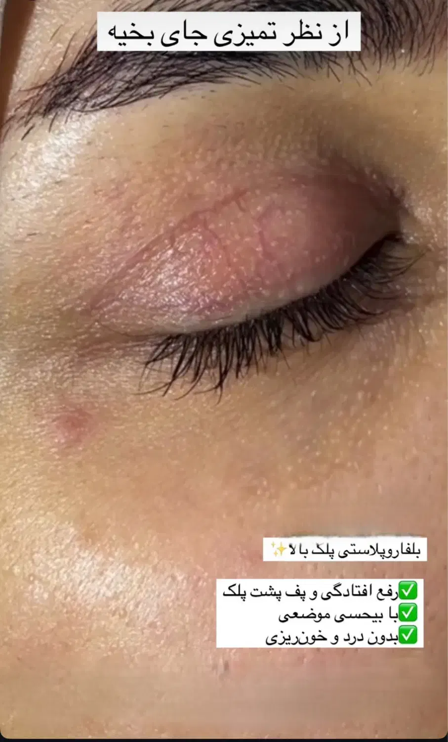انجام عمل جراحی توسط فوق تخصص جراحی پلاستیک|خدمات آرایشگری و زیبایی|تهران, بلوار کشاورز|دیوار