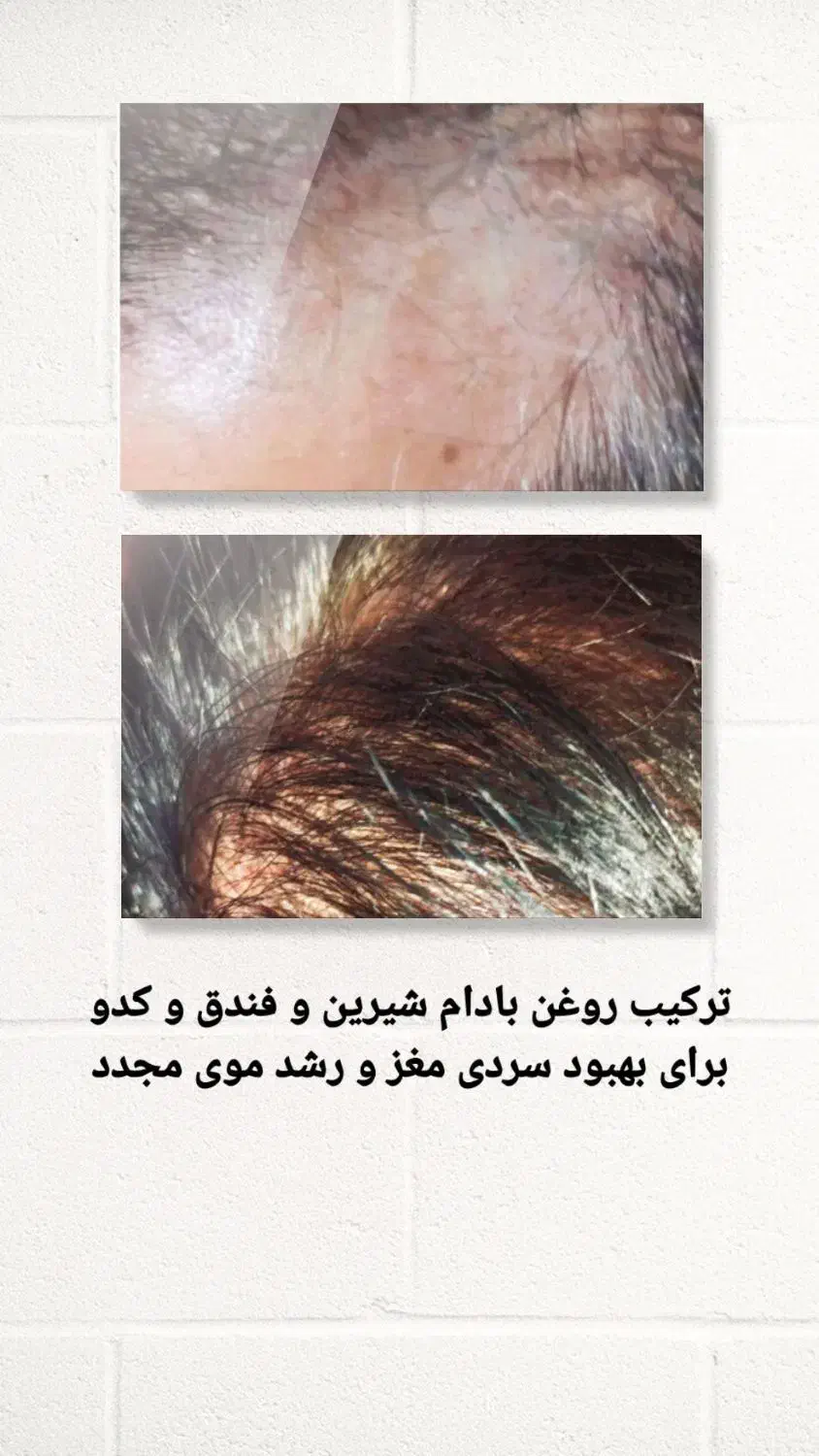 روغن های درمانی صددرصد خالص|حراج|کرج, دانشگاه هنر تهران (پردیس کرج)|دیوار