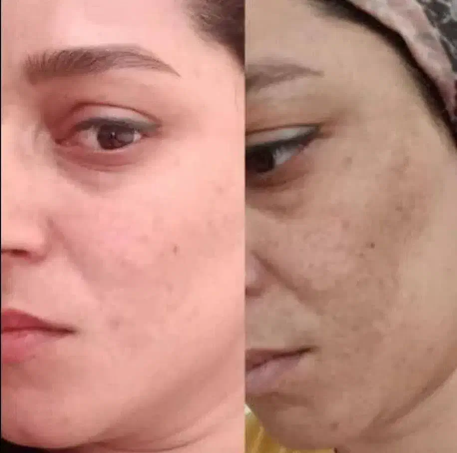 کرم گیاهی زیبایی|آرایشی، بهداشتی، درمانی|فولادشهر, A2|دیوار