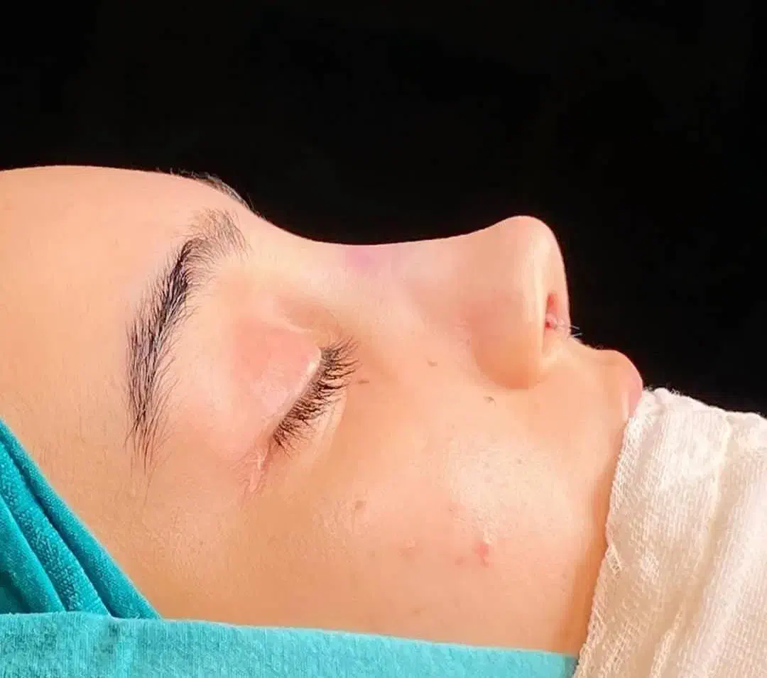 تخفیف عمل بینی لیپو ابدو لیفت ابرو وکاشت ابرو و مو|خدمات آرایشگری و زیبایی|اسلامشهر, شهرک لاله|دیوار