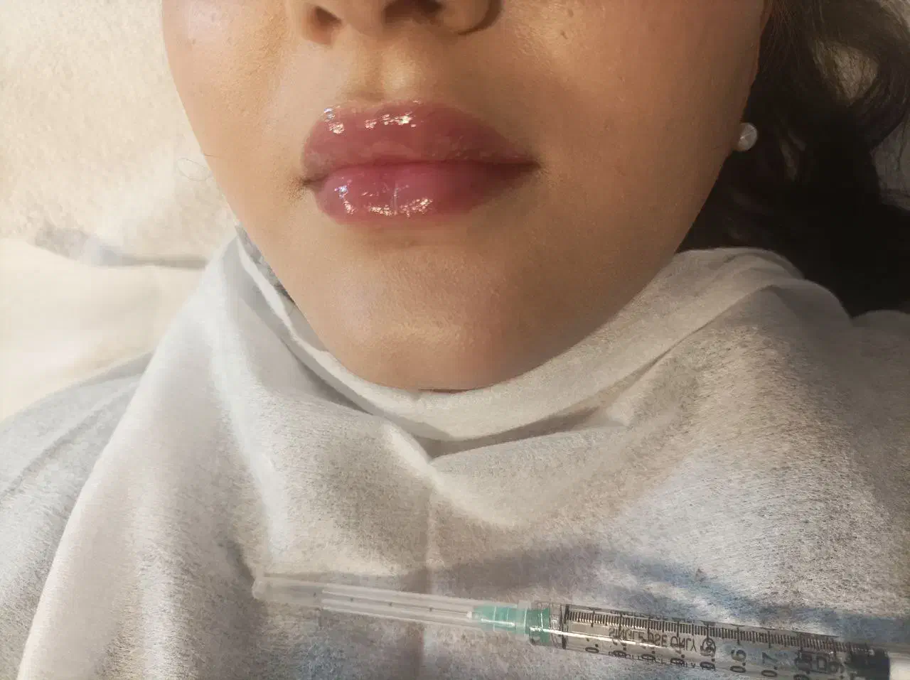 ژل بوتاکس فقط ۷۰۰|خدمات آرایشگری و زیبایی|مشهد, فرهنگ|دیوار