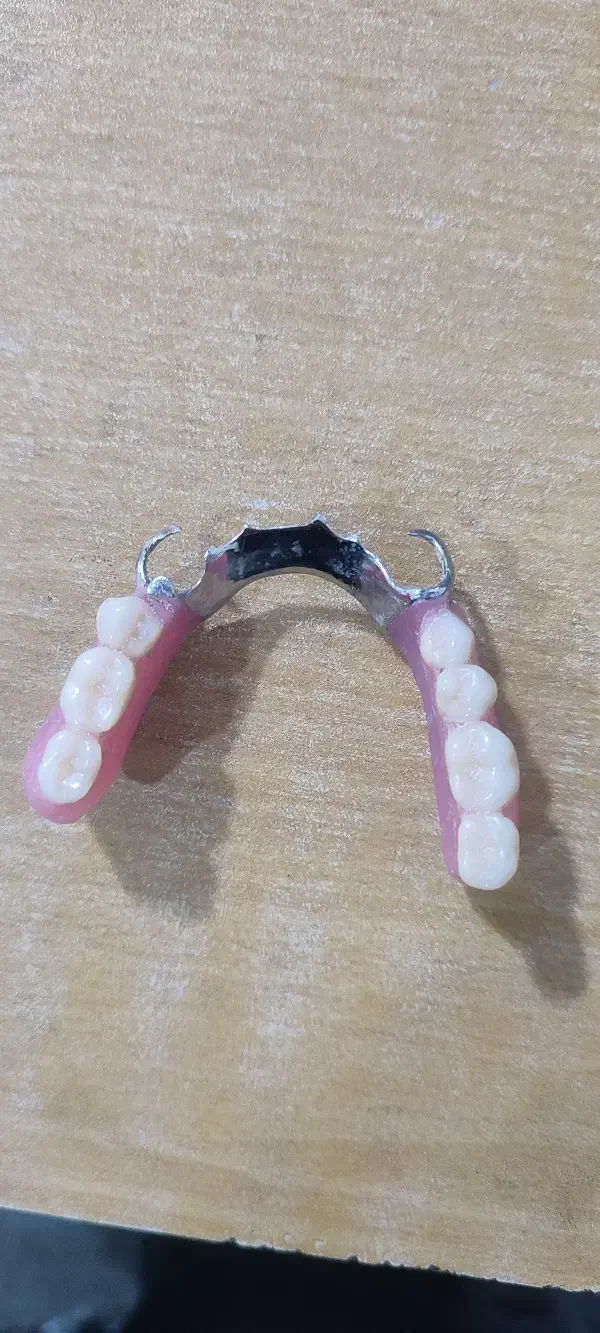 دندانسازی (دندان مصنوعی)|آرایشی، بهداشتی، درمانی|تبریز, |دیوار