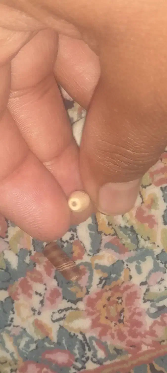 سنگ زیبا سوراخی|کلکسیون اشیاء عتیقه|زاهدان, |دیوار