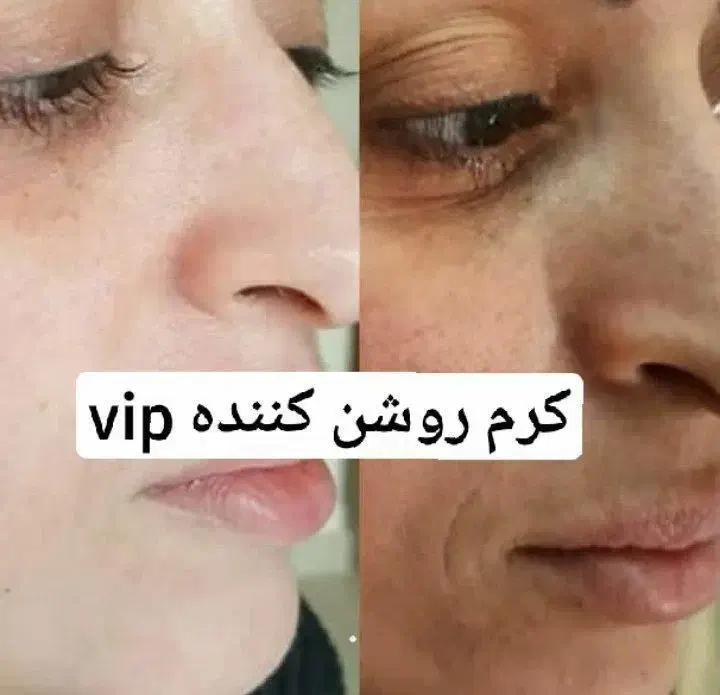 کرم معجزه زیبایی|خدمات آرایشگری و زیبایی|بجنورد, |دیوار