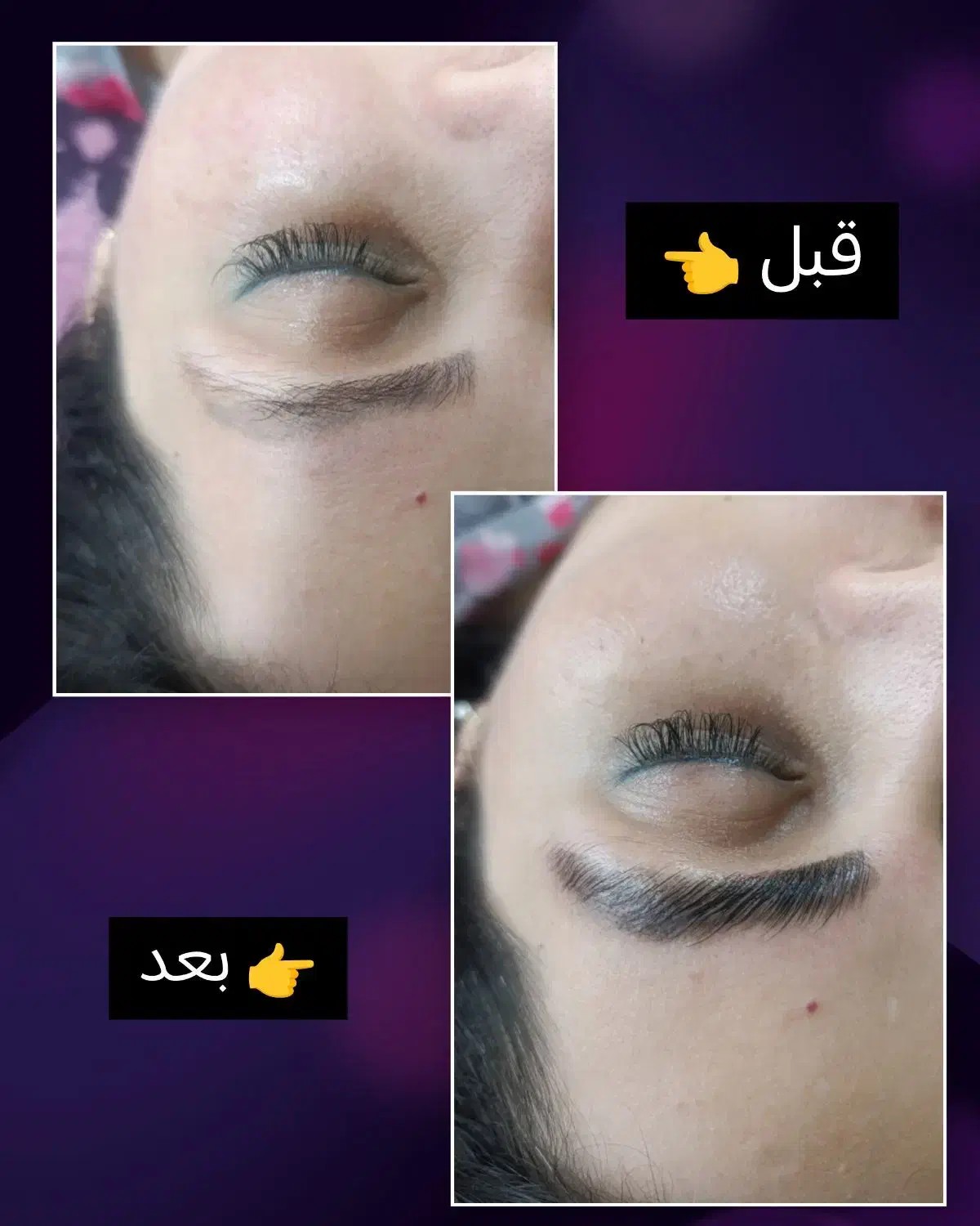 فیشال حرفه ای با دستگاه..|خدمات آرایشگری و زیبایی|گرگان, |دیوار