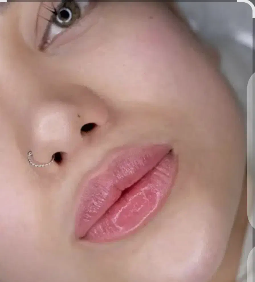 ژل بوتاکس|خدمات آرایشگری و زیبایی|جیرفت, |دیوار