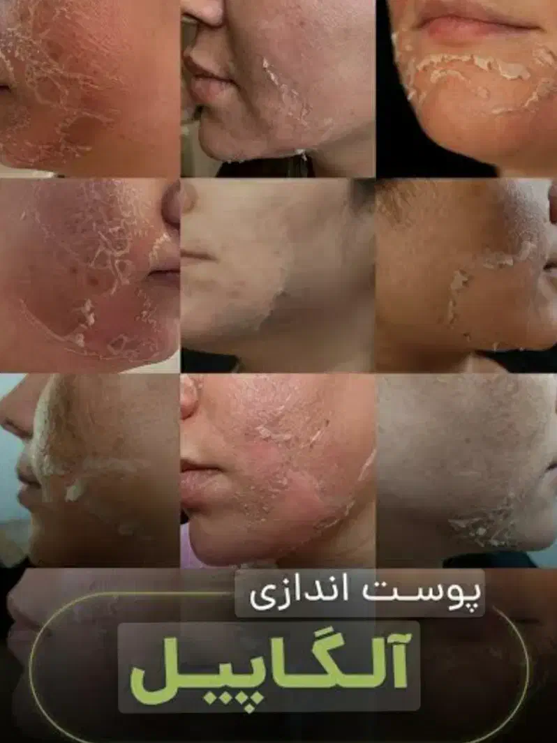 آموزش تخصصی فیشال و پاکسازی|خدمات آموزشی|کرمان, |دیوار