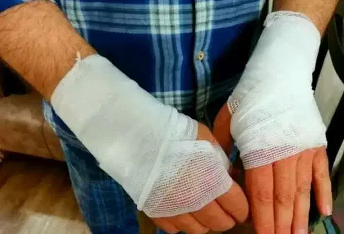 تزریقات،پانسمان،سرم،حجامت،فصدشبانه روزی درمنزل|خدمات آرایشگری و زیبایی|خرمآباد, |دیوار