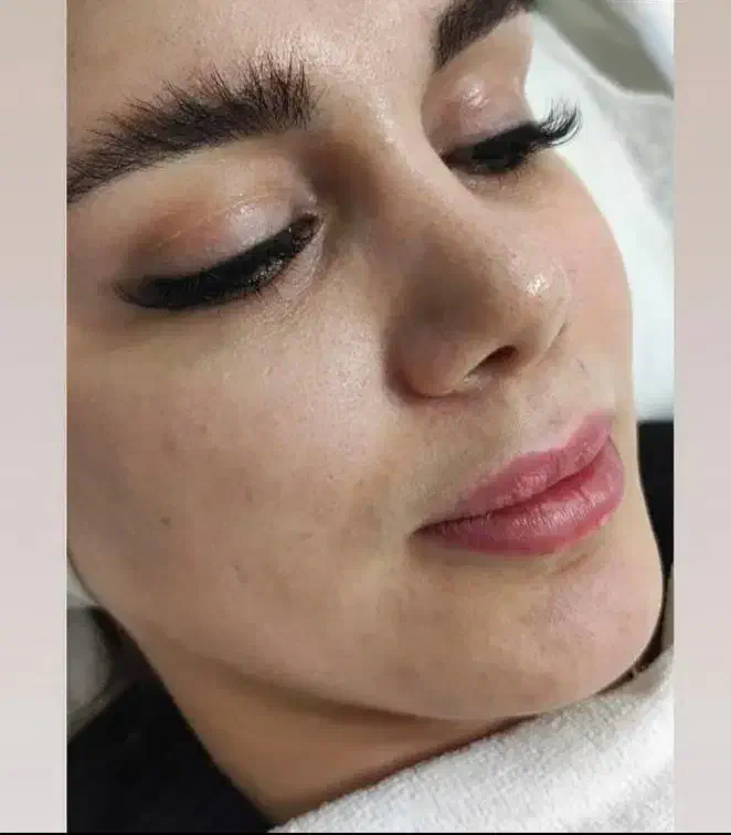 فیشیال صورت آقایان وخانم ها مطب دکتر پروین گودرزی|خدمات آرایشگری و زیبایی|یاسوج, |دیوار