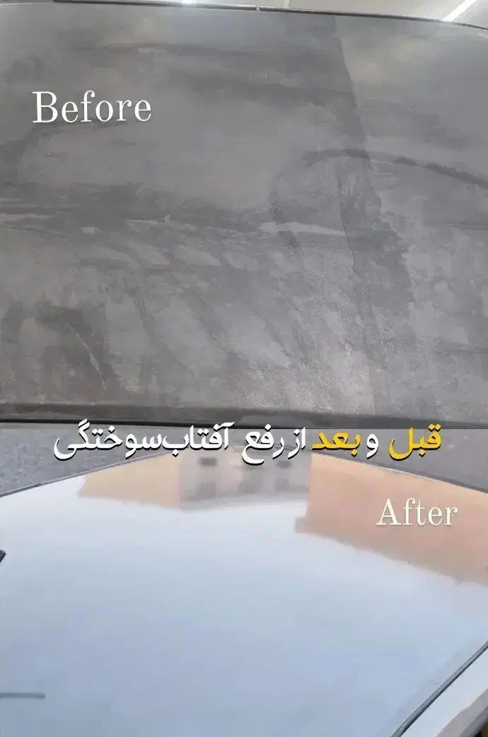 رفع آفتاب سوختگی|خدمات موتور و ماشین|قزوین, |دیوار