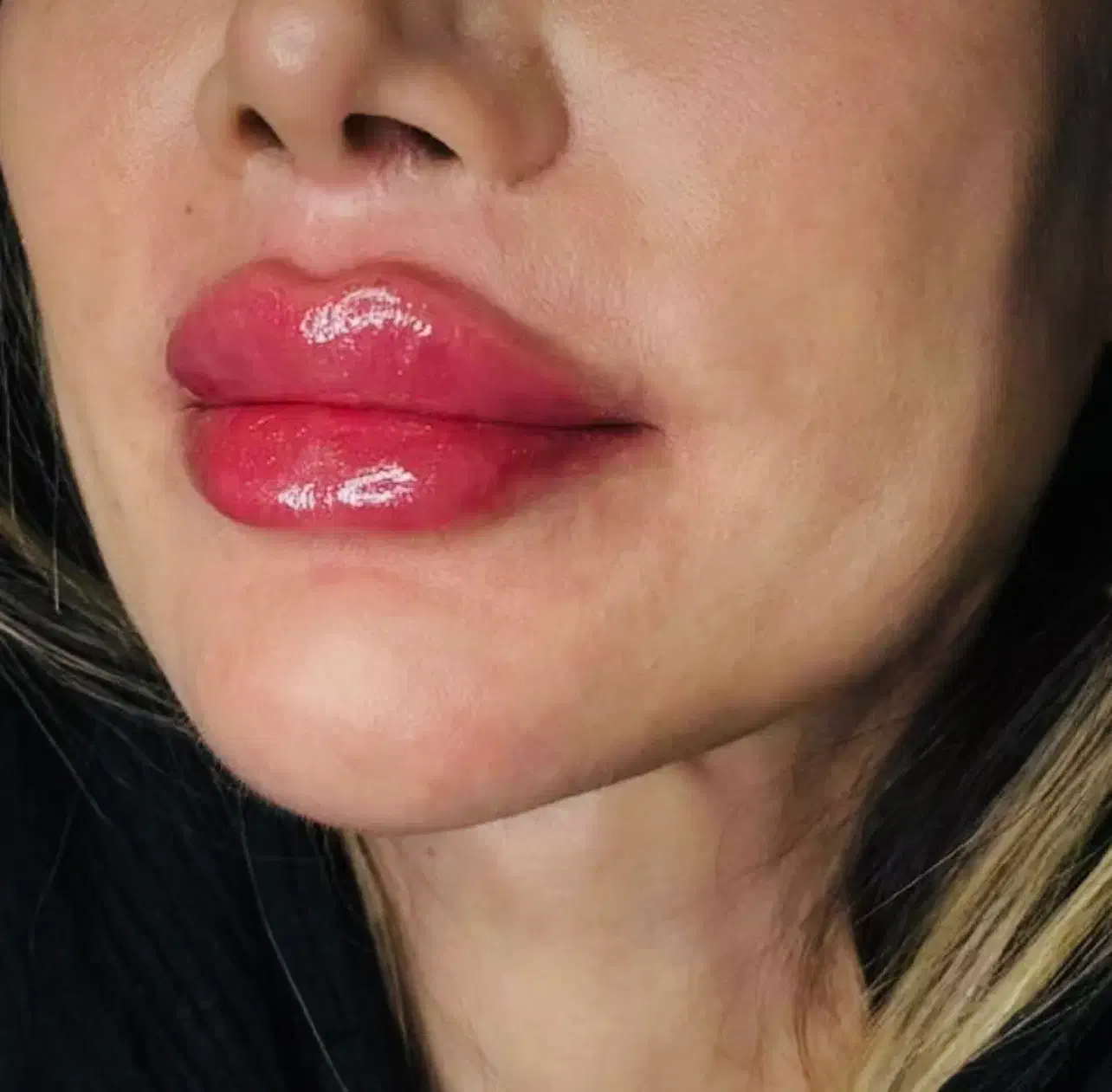 تخفیف بوتاکس و ژل|خدمات آرایشگری و زیبایی|دهگلان, |دیوار