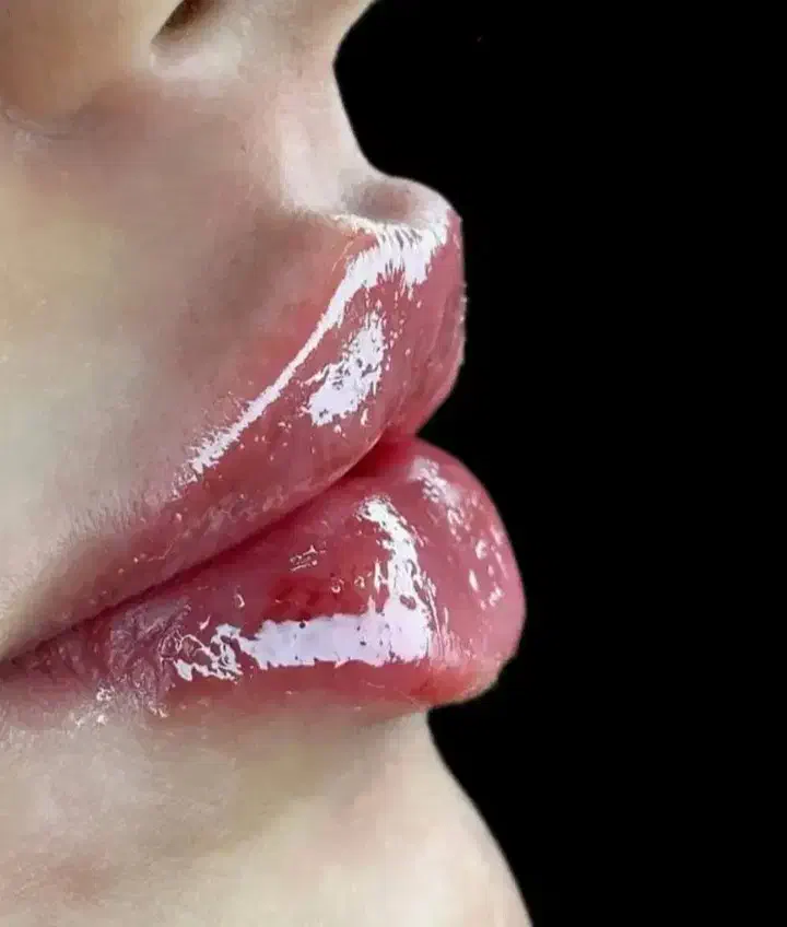 لیپو فیس غبغب و بوکال فت|خدمات آرایشگری و زیبایی|ری, ظهیرآباد|دیوار