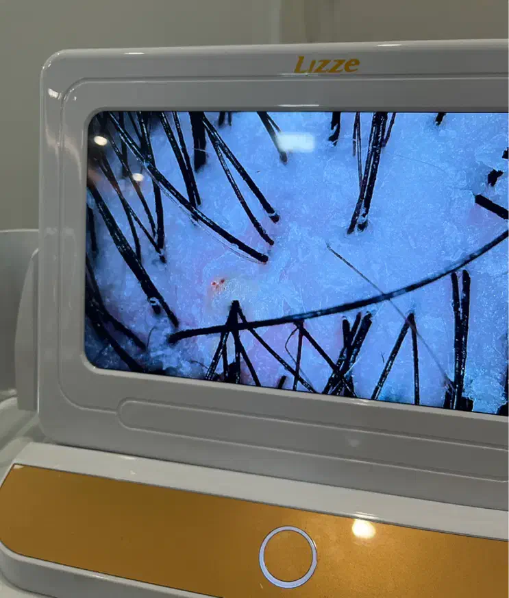 کراتین و اسکراب اسکالپ|خدمات آرایشگری و زیبایی|گرگان, |دیوار