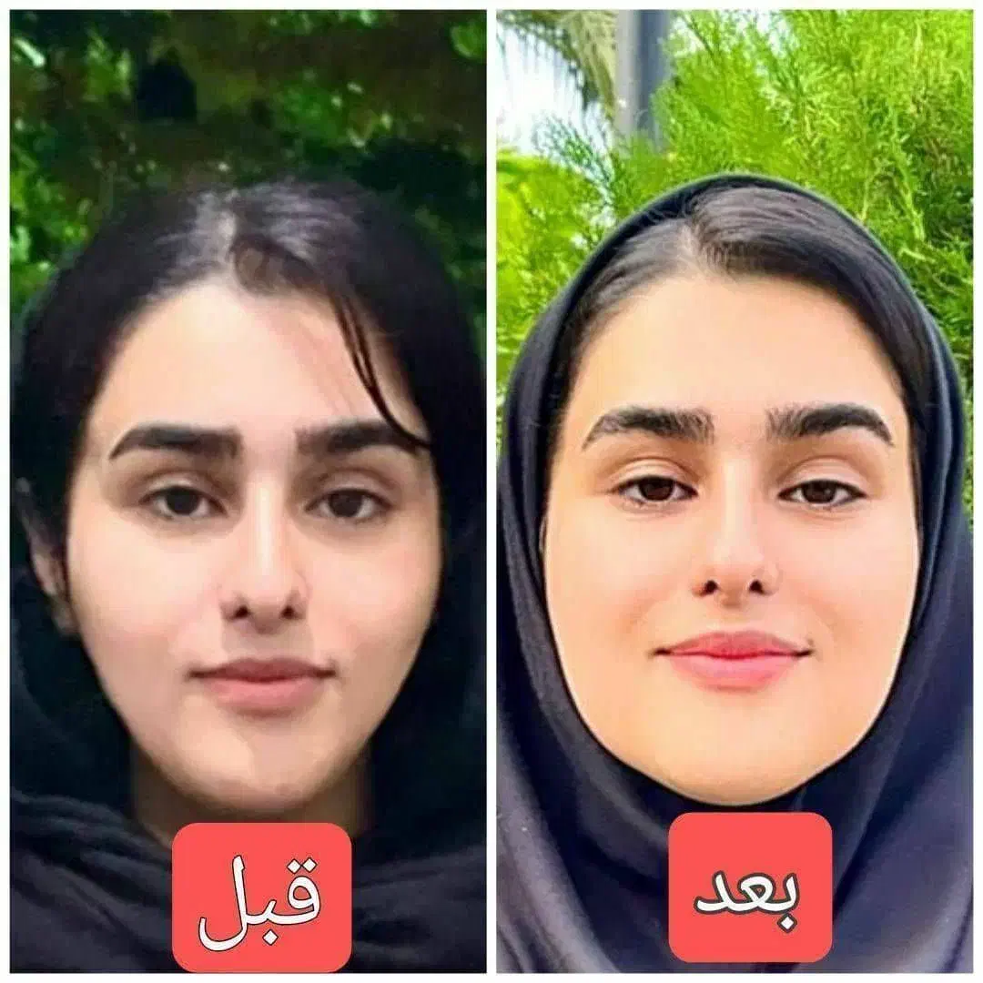 چاقی صورت به روش طبیعی|خوردنی و آشامیدنی|خاش, |دیوار