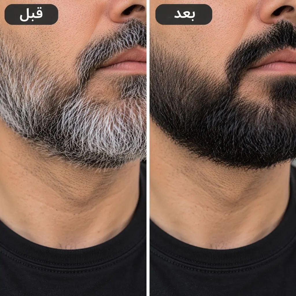 شامپورنگ موبابل موسm۵۰۰.پک تستردار.پرداخت درب منزل|آرایشی، بهداشتی، درمانی|تهران, ونک|دیوار