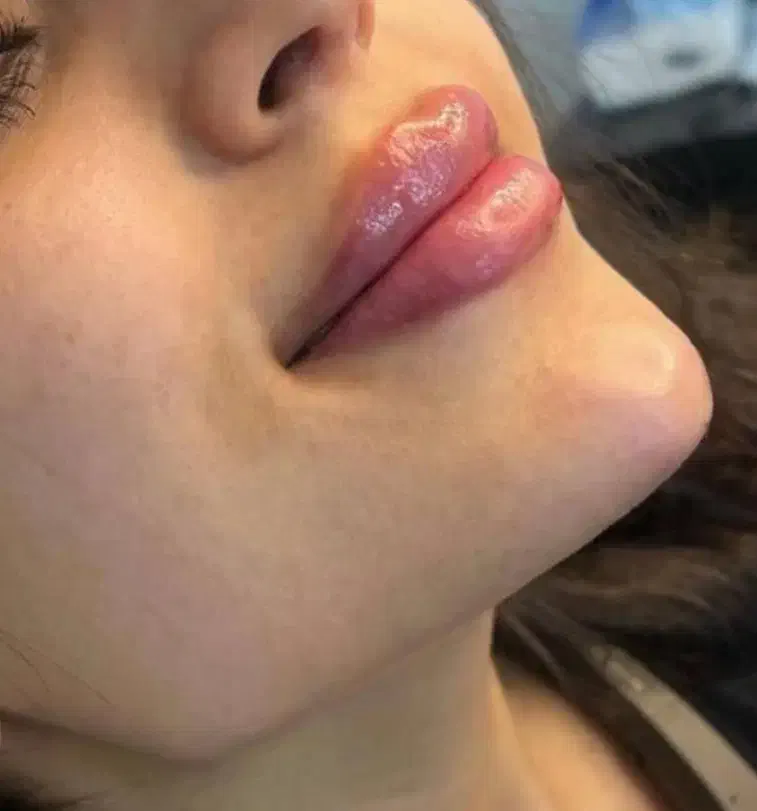 مدل ژل پیرسینگ مژه چال میکرو بوتاکس چشم گربه ای|خدمات آرایشگری و زیبایی|قم, نیروگاه|دیوار