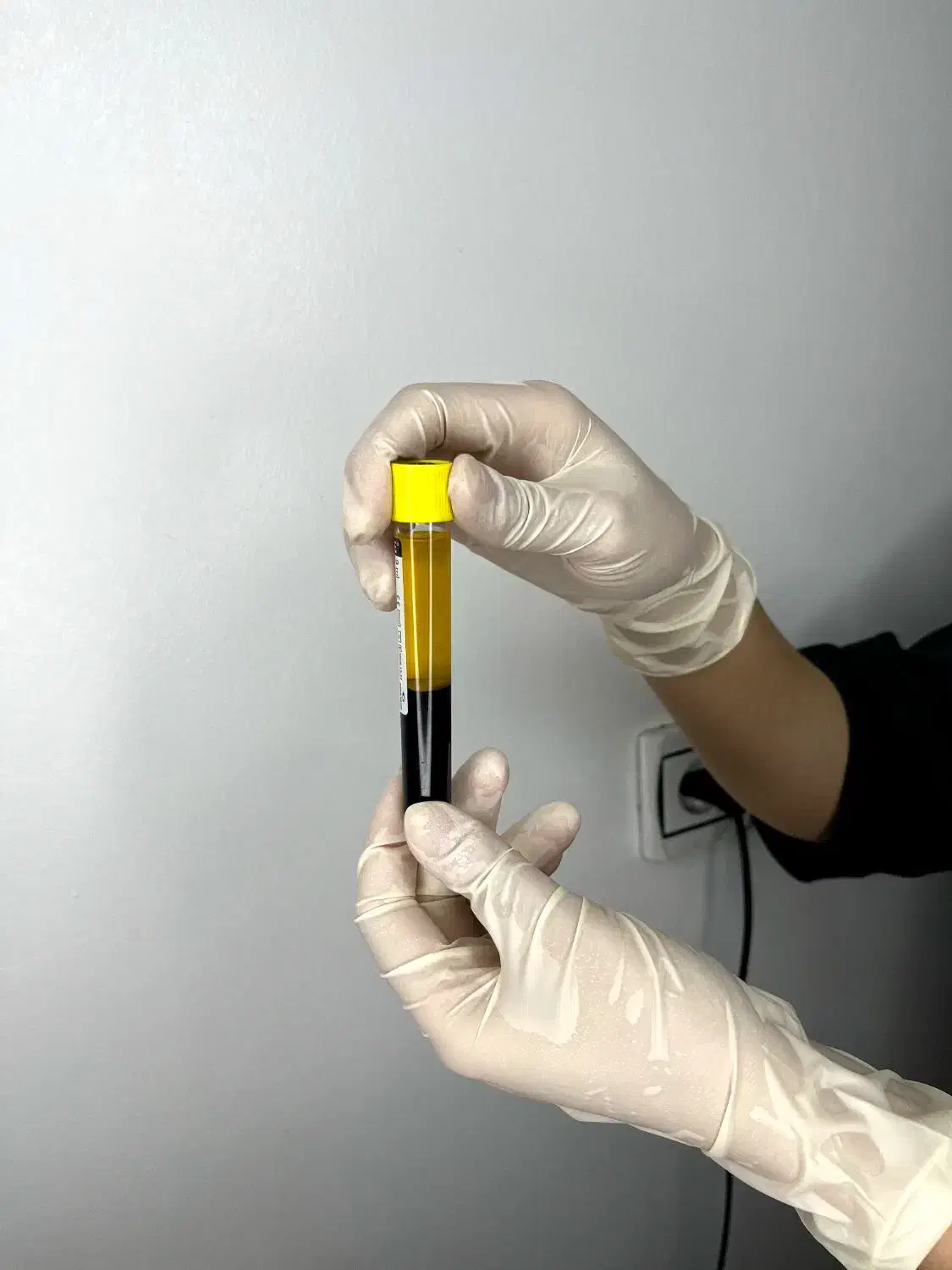 تخفیف ویژه پی آر پی|آرایشی، بهداشتی، درمانی|بهبهان, |دیوار