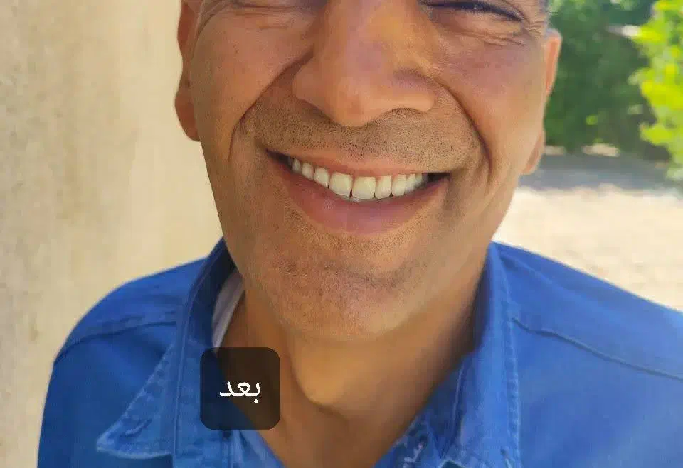 ساخت دندان مصنوعی کامل و تکه ای ضمانتی|آرایشی، بهداشتی، درمانی|مرودشت, بیست متری بیمارستان|دیوار