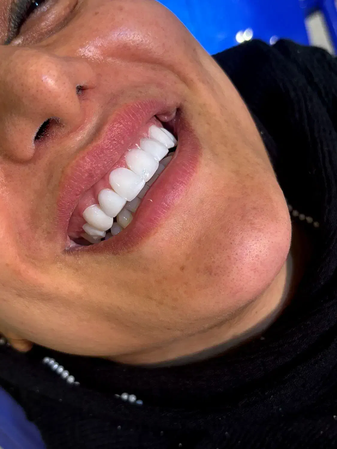 خدمات دندان پزشکی|خدمات آرایشگری و زیبایی|بروجرد, |دیوار