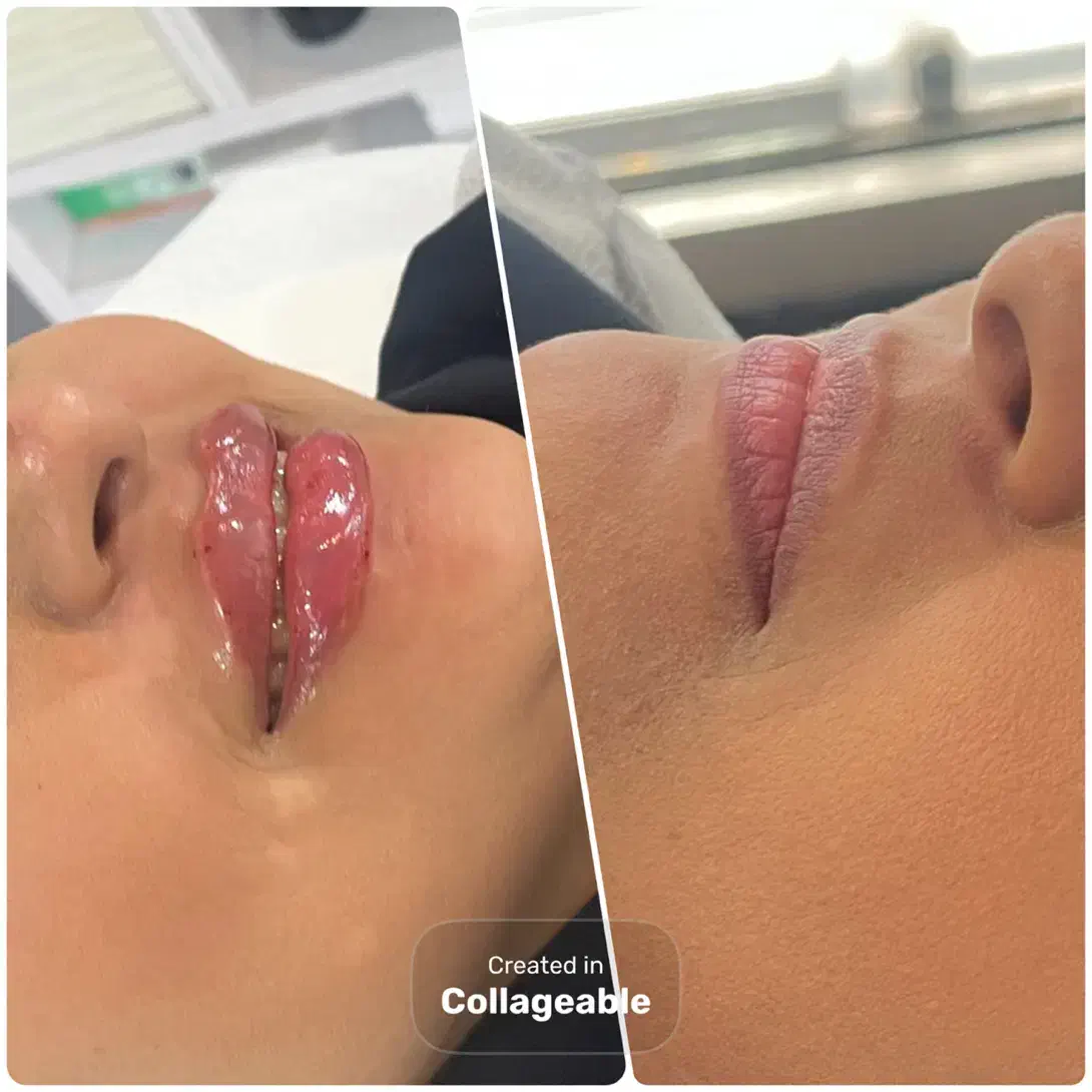 ژل لب روسی|خدمات آرایشگری و زیبایی|رشت, کاکتوس|دیوار