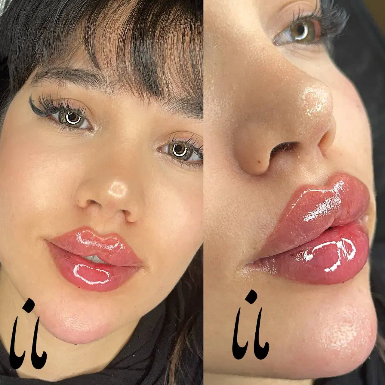 جشنواره ژل لب روسی فیلرزاویه بوتاکس مزو لیزرفیشیال|خدمات آرایشگری و زیبایی|شهریار, شهریار|دیوار